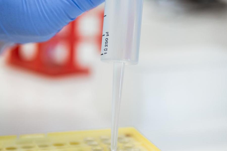 De laborant voegt een vloeistof toe aan de buisjes in de microplaat en zet de plaat een uur tot een nacht weg. In die tijd gaan de haarwortelcellen kapot en komt het DNA vrij