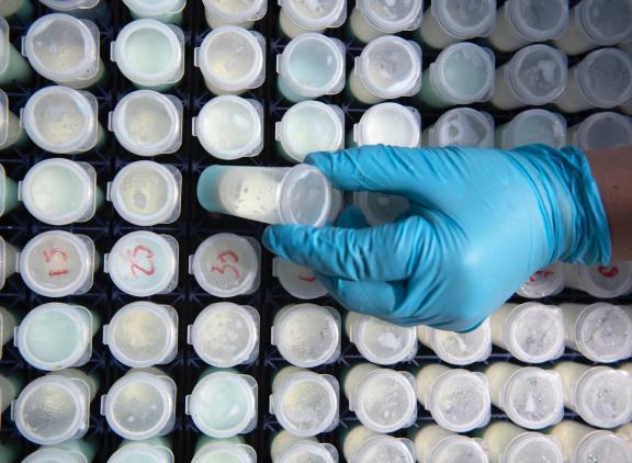 De Vlaamse koeien produceerden afgelopen jaar meer melk met lagere gehalten